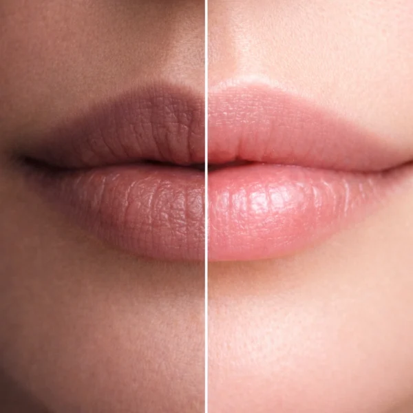 ඔබේ තොල් | Close-up split image of lips showing dark, dry, pigmented lips on one side and soft, hydrated, naturally pink lips on the other, representing natural lip care improvement.