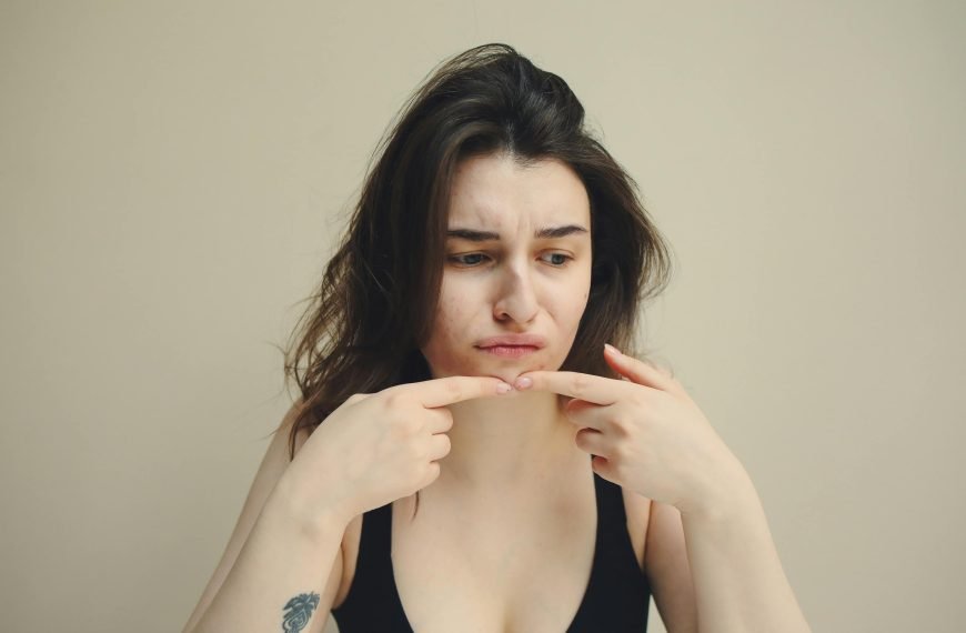 Get rid of acne forever.